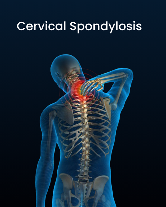 Cervical Spondylitis