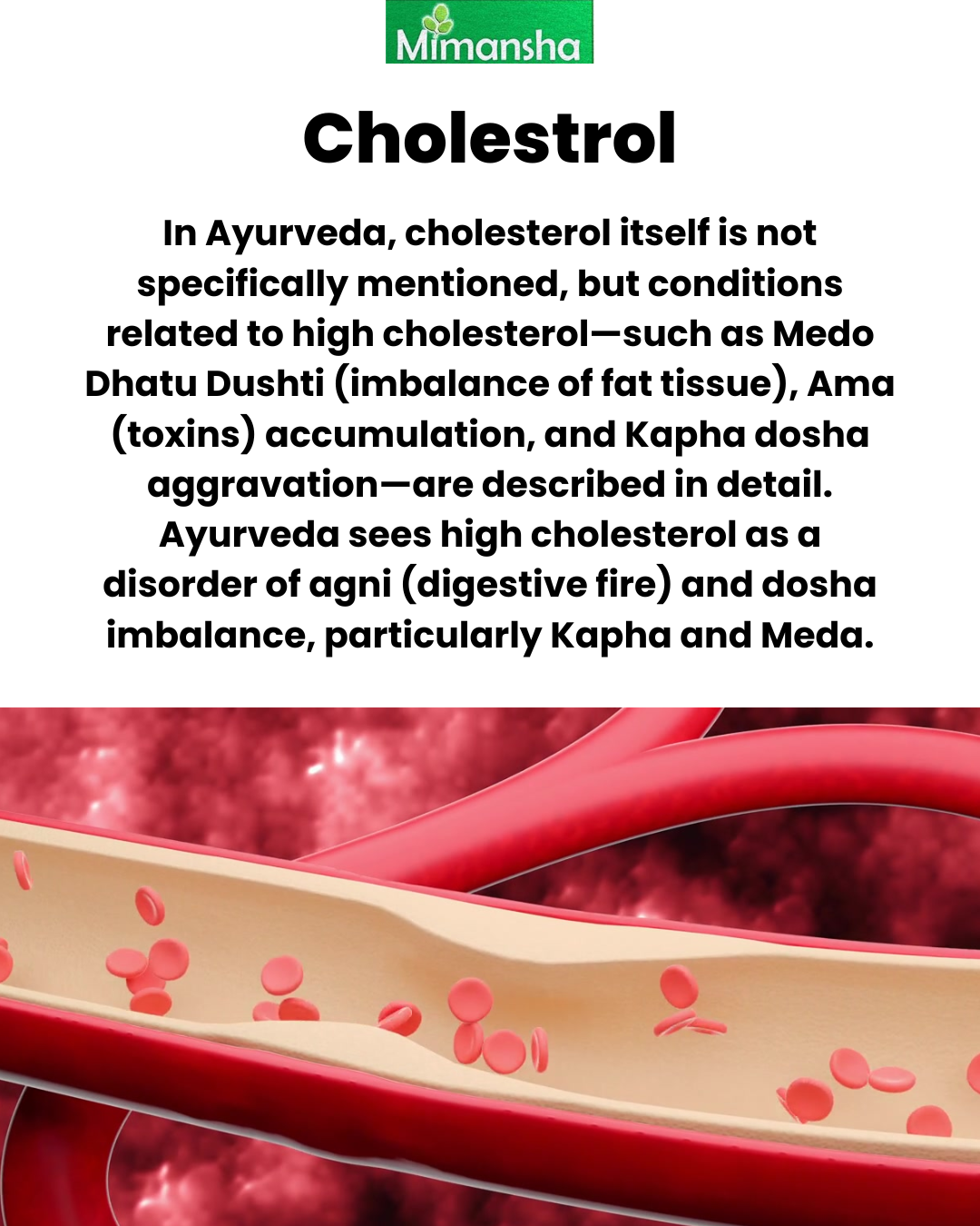 Cholesterol