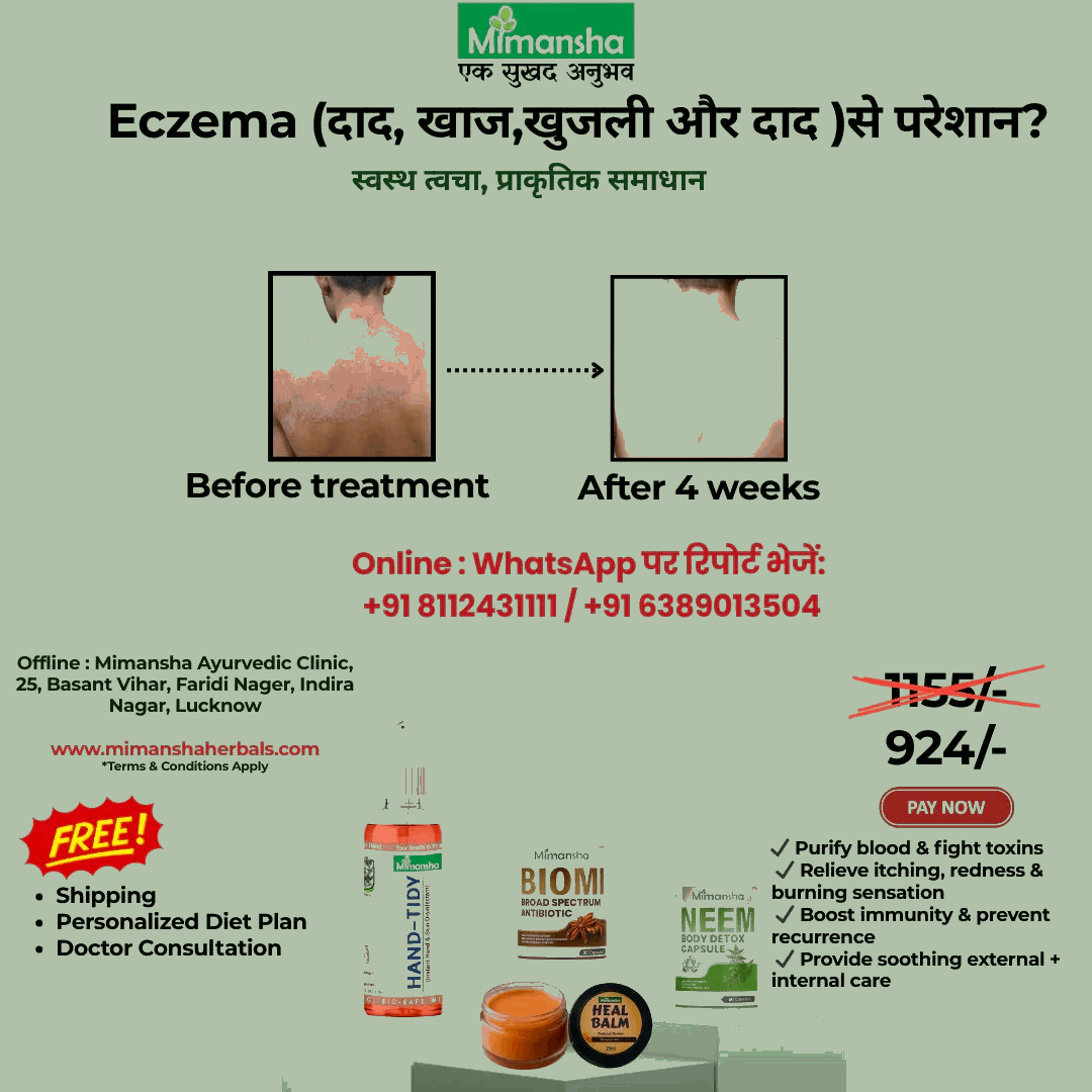 Mimansha Ayurvedic Eczema Relief Kit | 4-Week Natural Solution for Itching, Ringworm (Dad, Khaj)