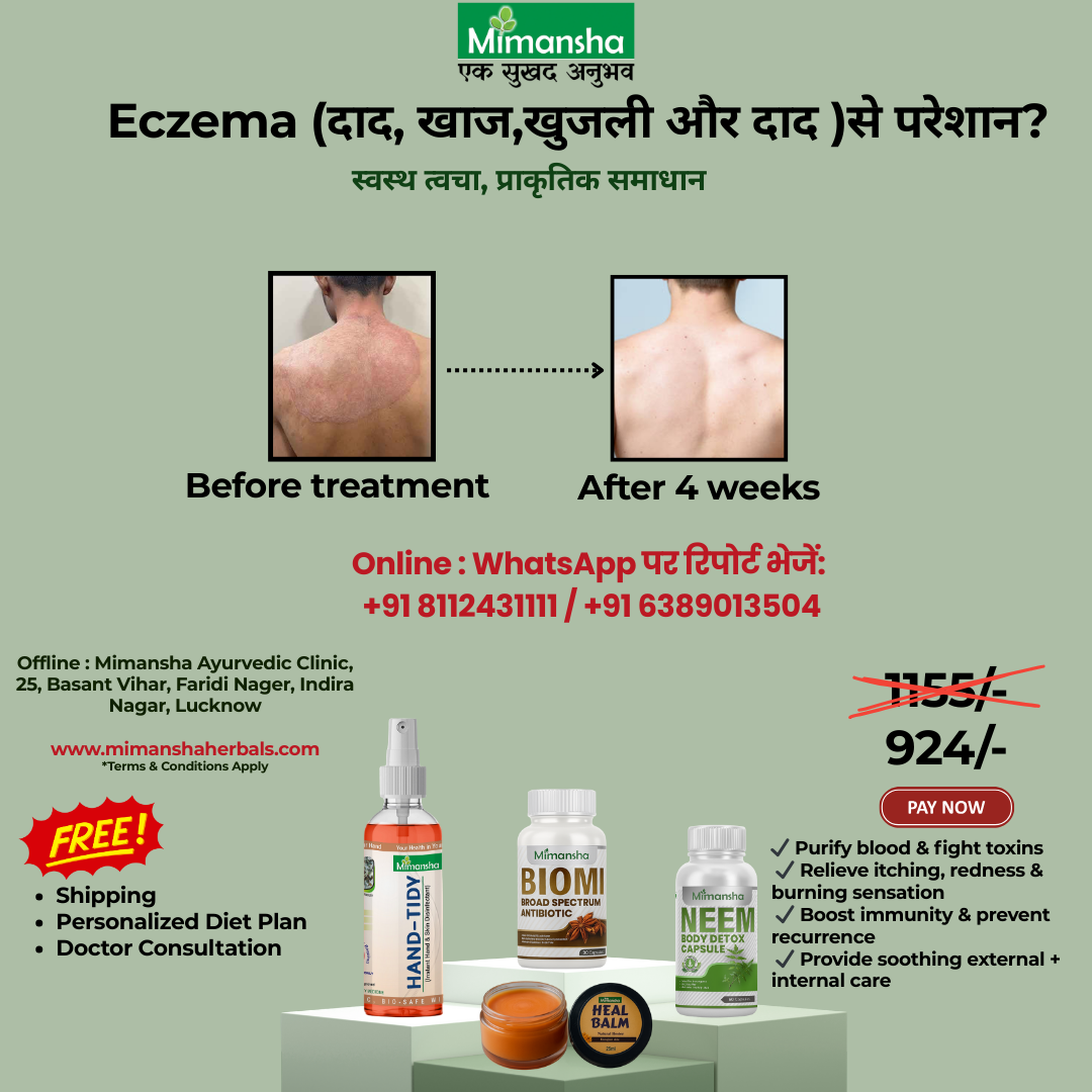 Mimansha Ayurvedic Eczema Relief Kit | 4-Week Natural Solution for Itching, Ringworm (Dad, Khaj)