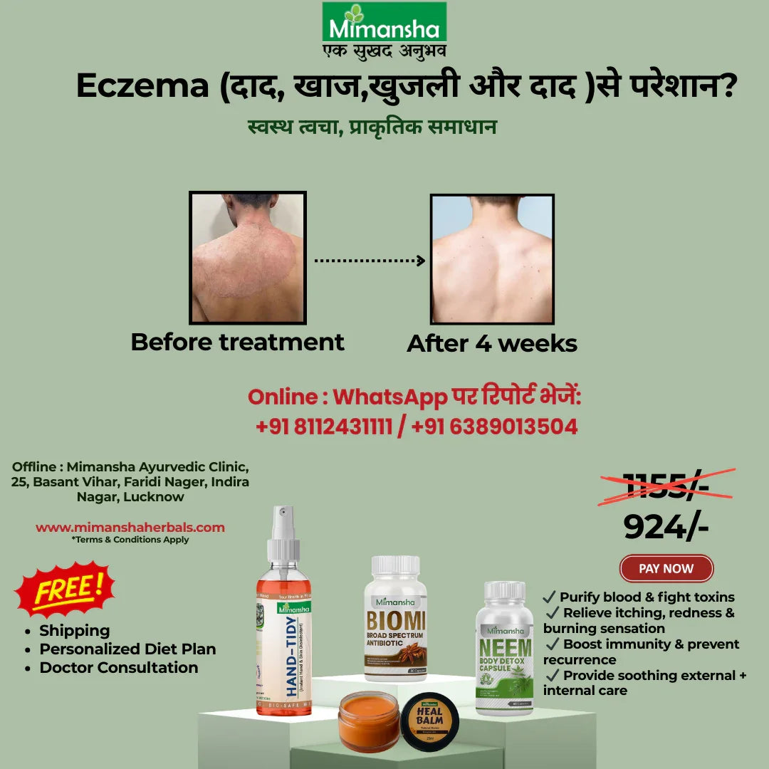 Mimansha Ayurvedic Eczema Relief Kit | 4-Week Natural Solution for Itching, Ringworm (Dad, Khaj)