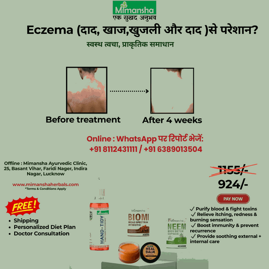Mimansha Ayurvedic Eczema Relief Kit | 4-Week Natural Solution for Itching, Ringworm (Dad, Khaj)