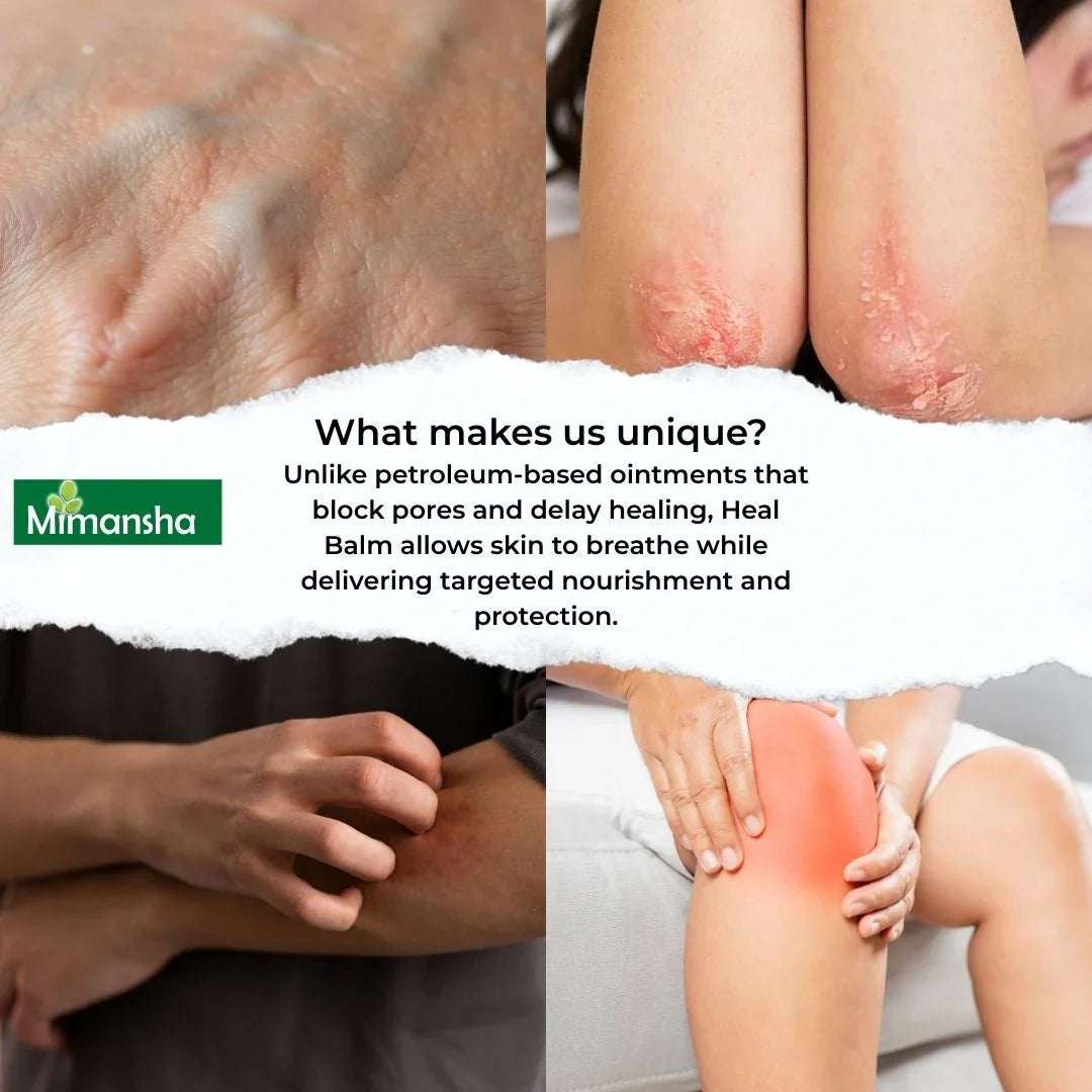 HEAL BALM – Ayurvedic Wound Healer & Skin Repair Balm