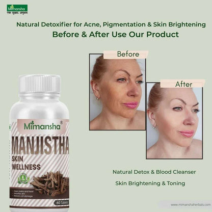Manjistha Tablets – Ayurvedic Supplement for Acne, Pigmentation & Skin Brightening