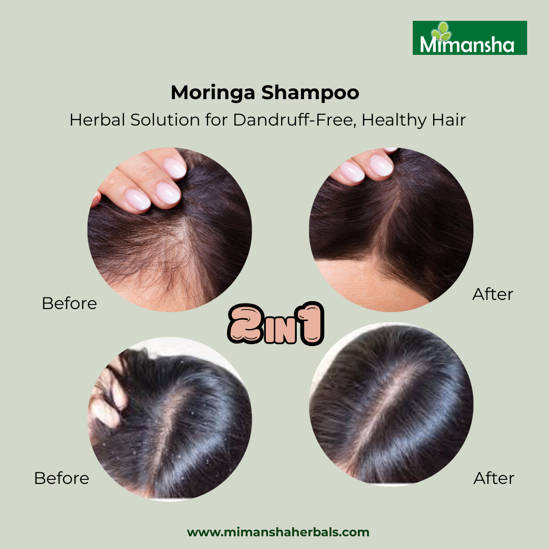Moringa Shampoo (Eucalyptus & mint).